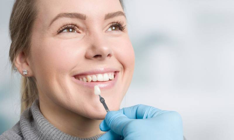 veneers